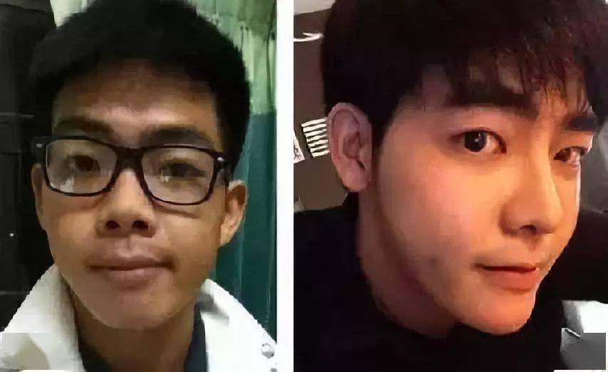 生活|泰国小哥花15万整形，成功从屌丝逆袭变男神！