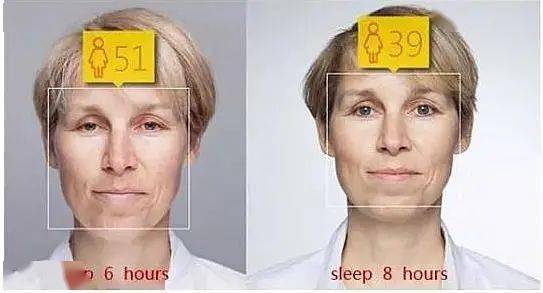 贫民窟|杨幂熬夜后护肤要花2万块？怪不得皮肤吹弹可破！贫民窟女孩就不配消除熬夜痘、黑眼圈吗？