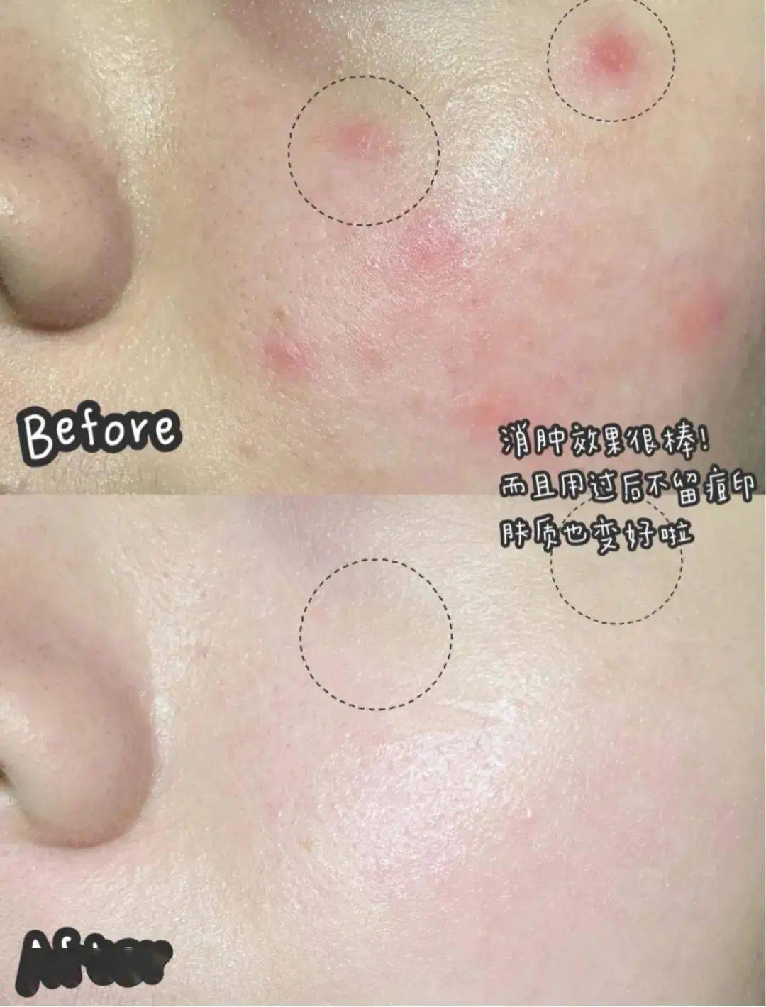 贫民窟|杨幂熬夜后护肤要花2万块？怪不得皮肤吹弹可破！贫民窟女孩就不配消除熬夜痘、黑眼圈吗？