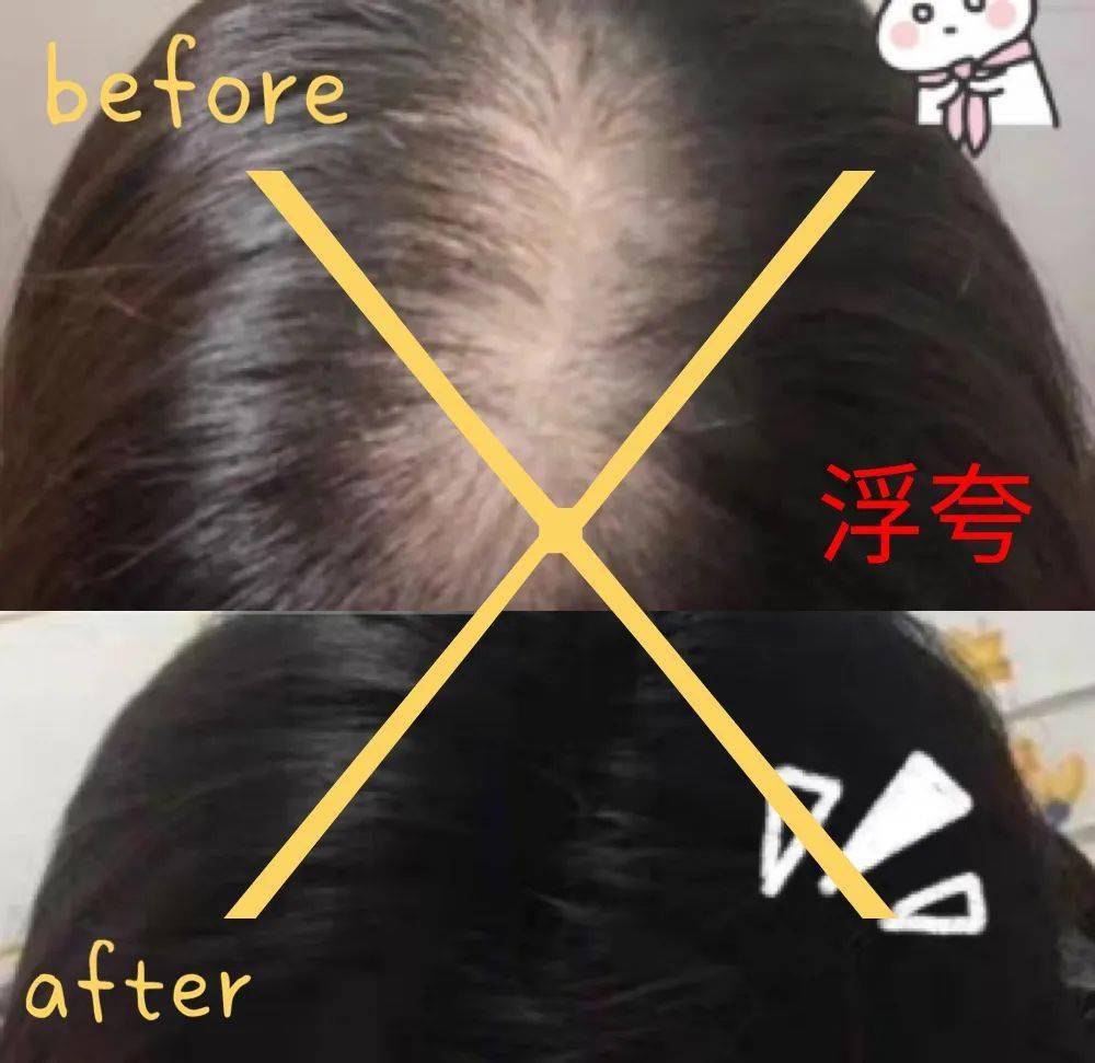 索芙特|原来发际线后移还能这样遮!我终于可以拥有“海藻头”啦