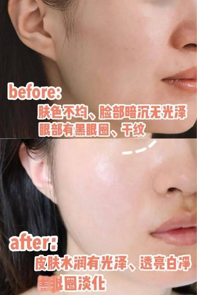 贫民窟|杨幂熬夜后护肤要花2万块？怪不得皮肤吹弹可破！贫民窟女孩就不配消除熬夜痘、黑眼圈吗？