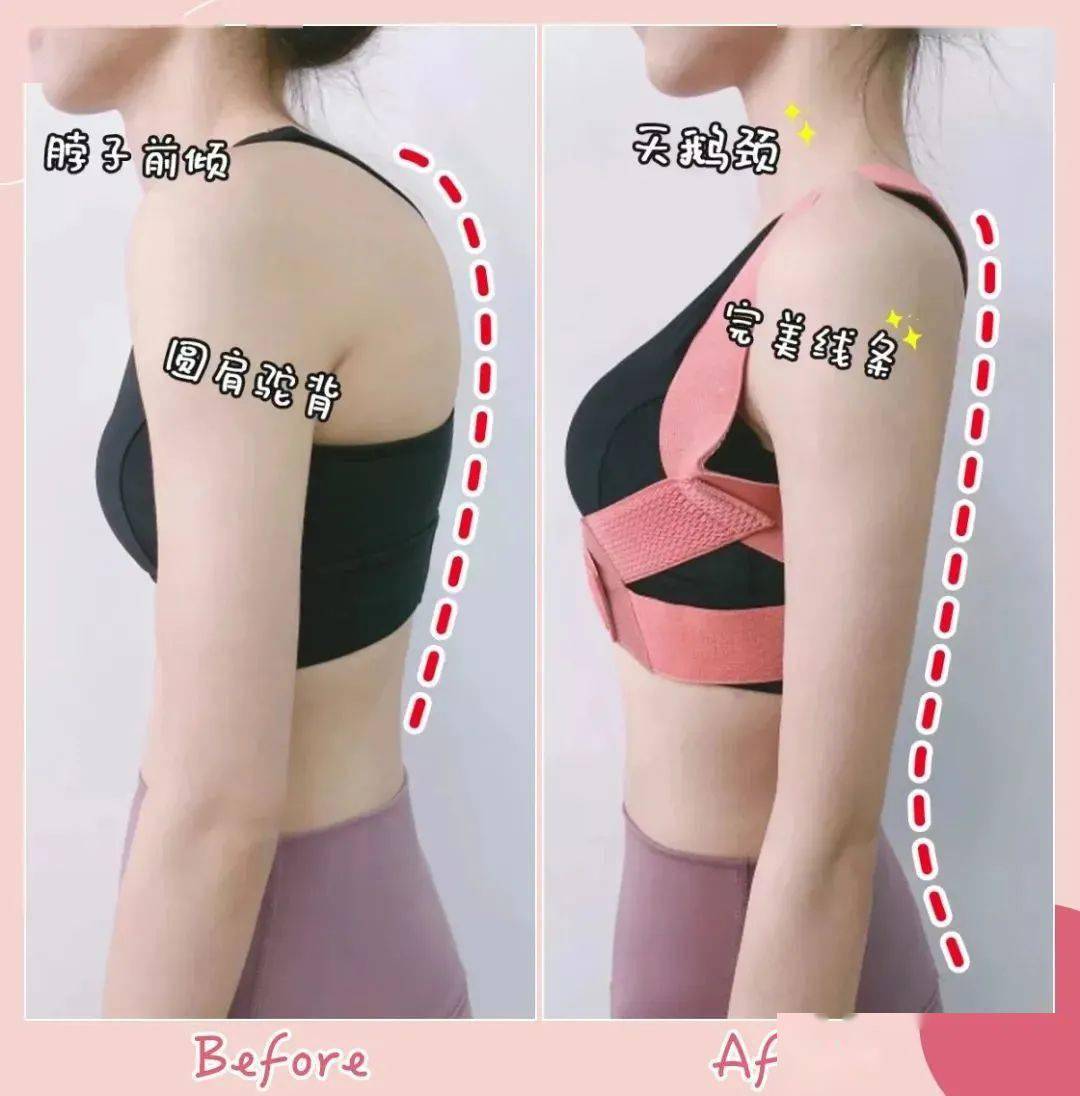 矫姿|被扒出来了！张雨绮“浪姐”全程穿它塑形！1s挺拔，让你气质好到爆