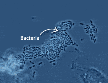 贫民窟|杨幂熬夜后护肤要花2万块？怪不得皮肤吹弹可破！贫民窟女孩就不配消除熬夜痘、黑眼圈吗？