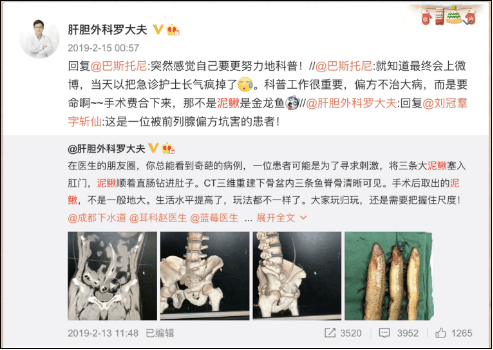 异物|【周日】罗非鱼“游”进肛门，医生在直肠里找到啤酒杯、茄子、灯泡、泥鳅.....
