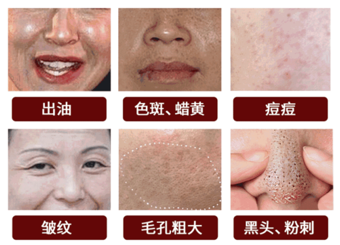 日本|日本人用酒洗脸，60岁还没有皱纹，黑头粉刺全消失，整张脸白皙光滑，细腻弹润！