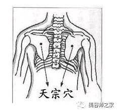 成语什么灸_脾虚艾灸什么部位图