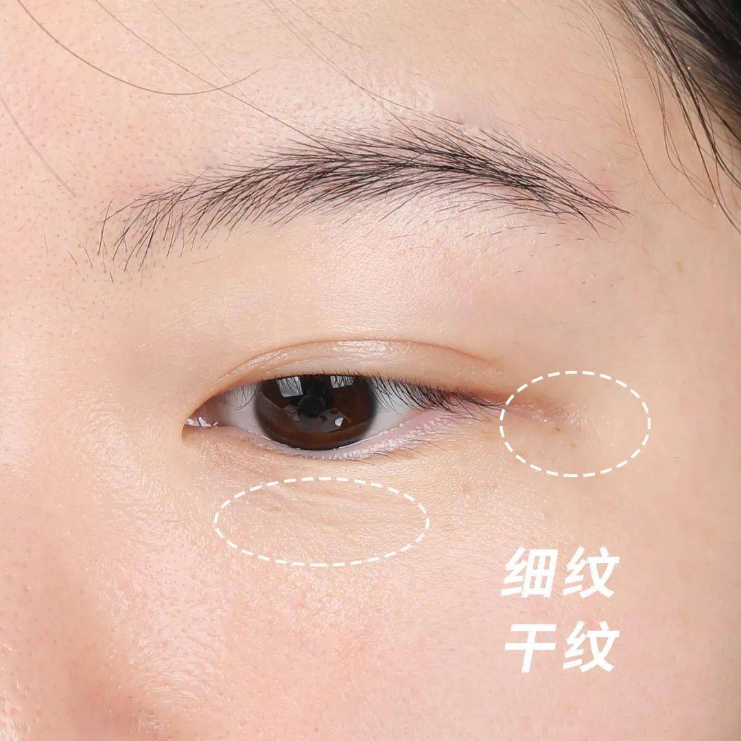 肌肤|花了三天三夜,我终于整理出了超全的抗老功课!