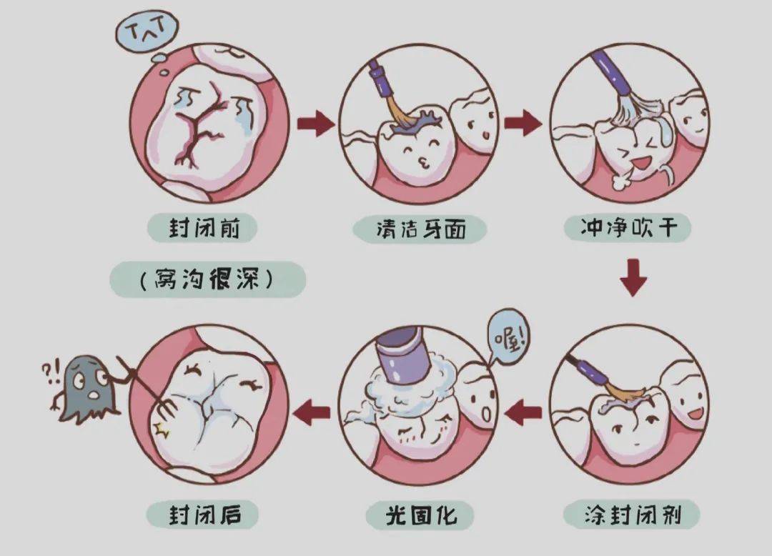 口腔|一起来聊聊这10个关于孩子的口腔问题|七巧板育儿堂