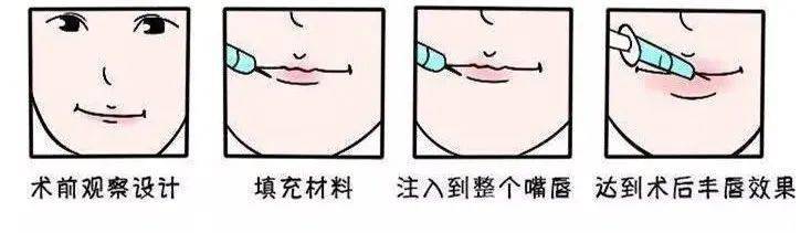 双眼皮|为什么“整容脸”女孩,更受直男欢迎?