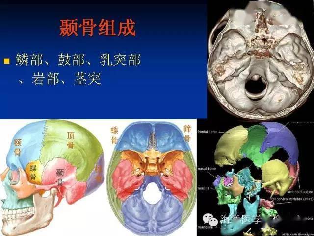 耳部ct及mri解剖