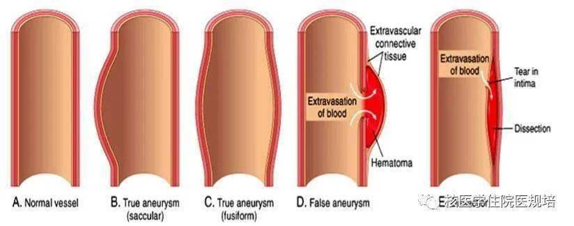 血管|人体最痛的六种病，痛风仅排第五！希望你一个都没经历过