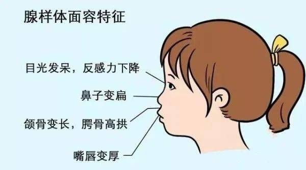 扁桃体肥大导致儿童打呼噜、张口呼吸，应该怎么办?