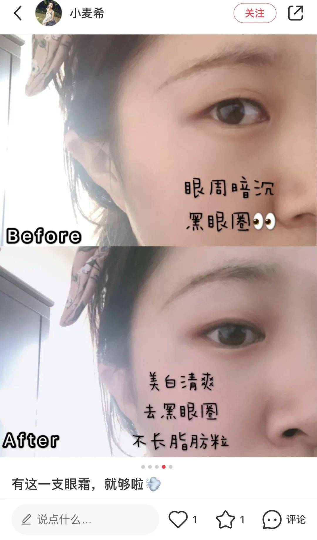 黑眼圈|实名推荐这款国货眼霜,99元去掉20年的熊猫眼,还不长脂肪粒!