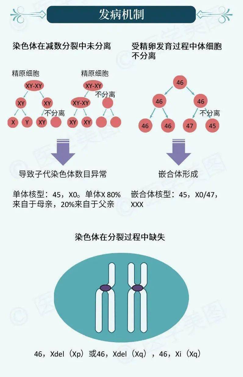 特纳综合征的故事 | 美图赏析_手机搜狐网