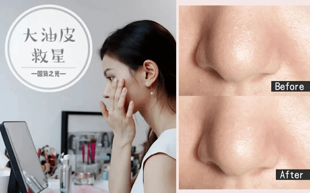 皮肤|翻红女星这都几年没接戏了，还敢这么浪呢？