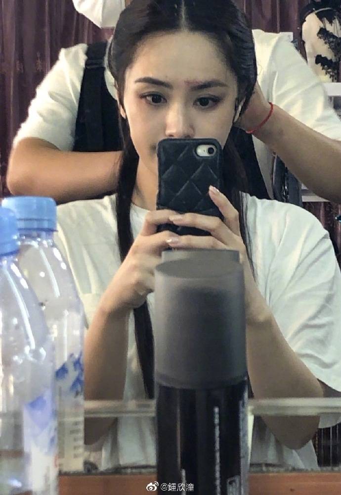 伤口|阿娇晒伤口照，疑回应炒作质疑