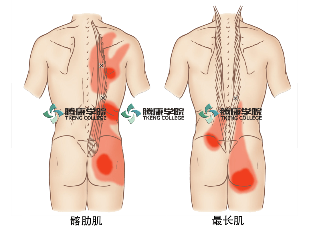 中背部疼痛七块肌肉