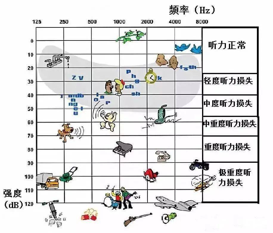 听力损失听力损失有分级外伤:引起并发耳聋.