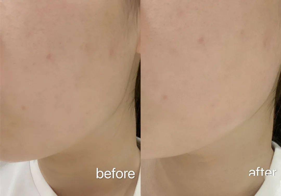 Bug|寻芳记｜换季肤况出Bug？听说比奶茶还甜的她们都用这招！