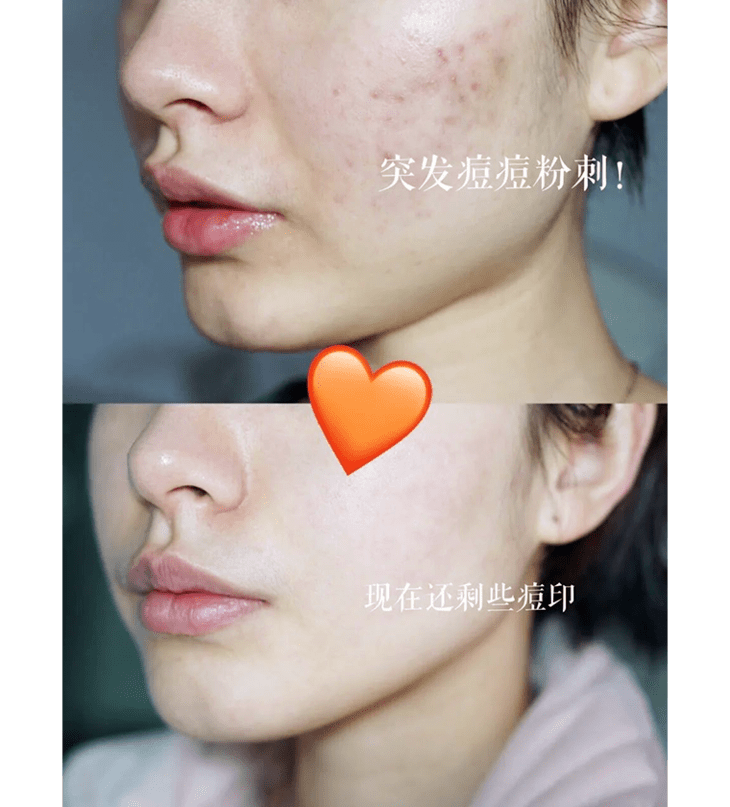 皮肤|2个小样=1个正装，雅诗兰黛小棕瓶套装降价了！价格直逼专柜3折
