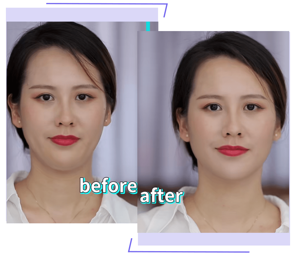 张雨绮|人间富贵花张雨绮，没了他真的不行！