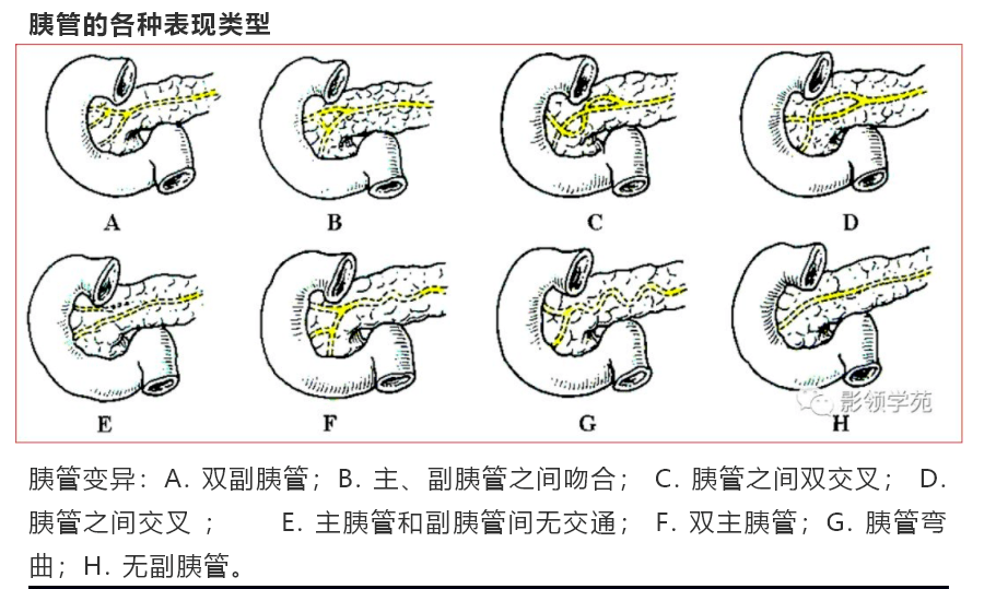 胰腺的解剖与常见变异