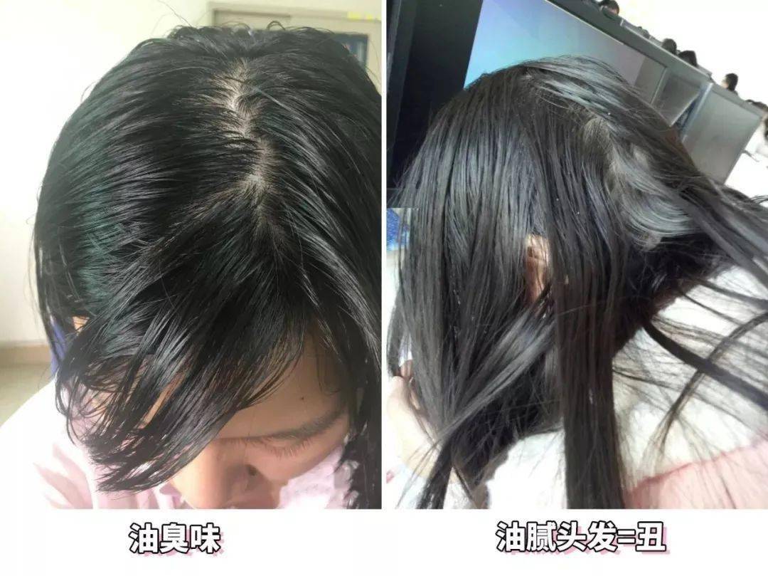 头发|头皮发痒，出油，还掉发？原来是你的洗发水没选好...