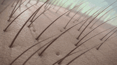 头发|头皮发痒，出油，还掉发？原来是你的洗发水没选好...