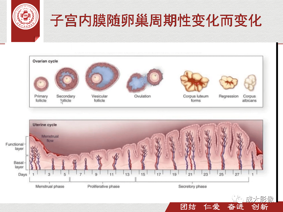 超赞子宫mr扫描规范正常表现及子宫内膜癌的分期