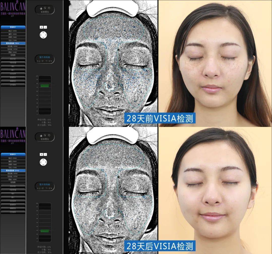 女人|如果你正长“色斑”,试试这个新方法,惊喜到让你尖叫!