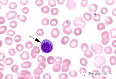四川省2019年第2次血细胞形态学检查室间质量评价