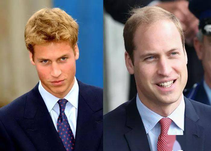 品牌|热销260万个的菊星洗发皂，日本天皇御用品牌，轻松搞定油腻脱发！