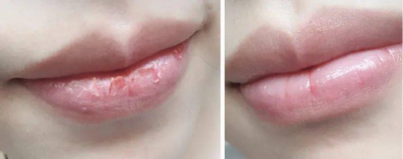 嘴唇|那些懂得珍爱自己的女孩儿，过得比较开心