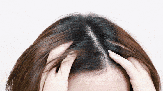 国货|还是老国货好使，头发长出来了，看着真年轻