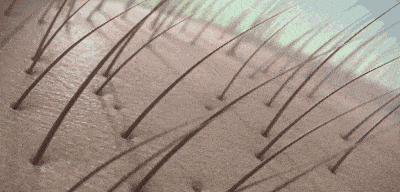 国货|还是老国货好使，头发长出来了，看着真年轻