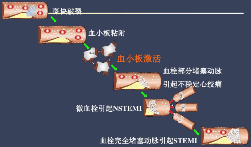 病理生理 1)血流动力学变化