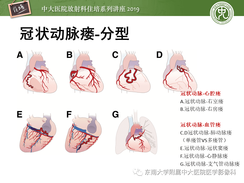 搭脉怎么判断早搏_早搏心电图怎么看图解(3)