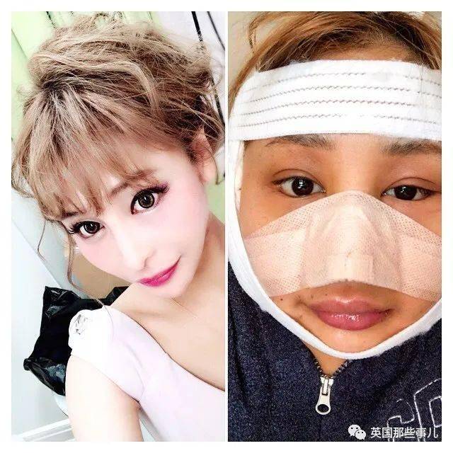 妹子|霓虹妹子整容上百次＂走上人生巅峰＂，以后还想整成桥本环奈…