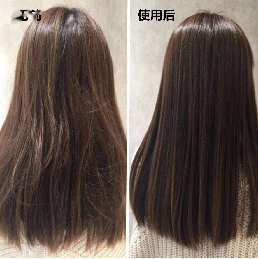 女人|懂得往脸上抹油的女人，还打个P玻尿酸！