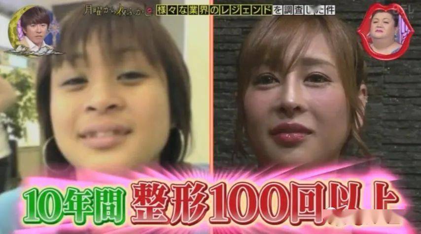 妹子|霓虹妹子整容上百次＂走上人生巅峰＂，以后还想整成桥本环奈…