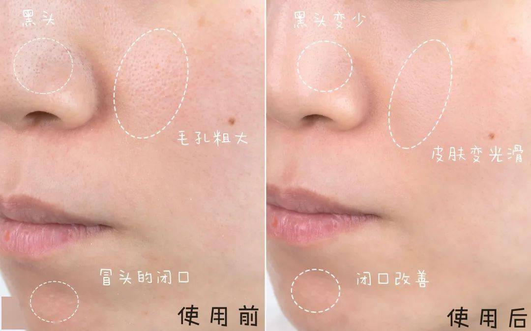 怎么样才能皮肤变干净 8dbf84dea26840f6967c438e754eb8a4.jpeg