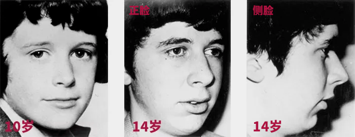 嘴唇|听说80%的人都在为这个颜值bug苦恼