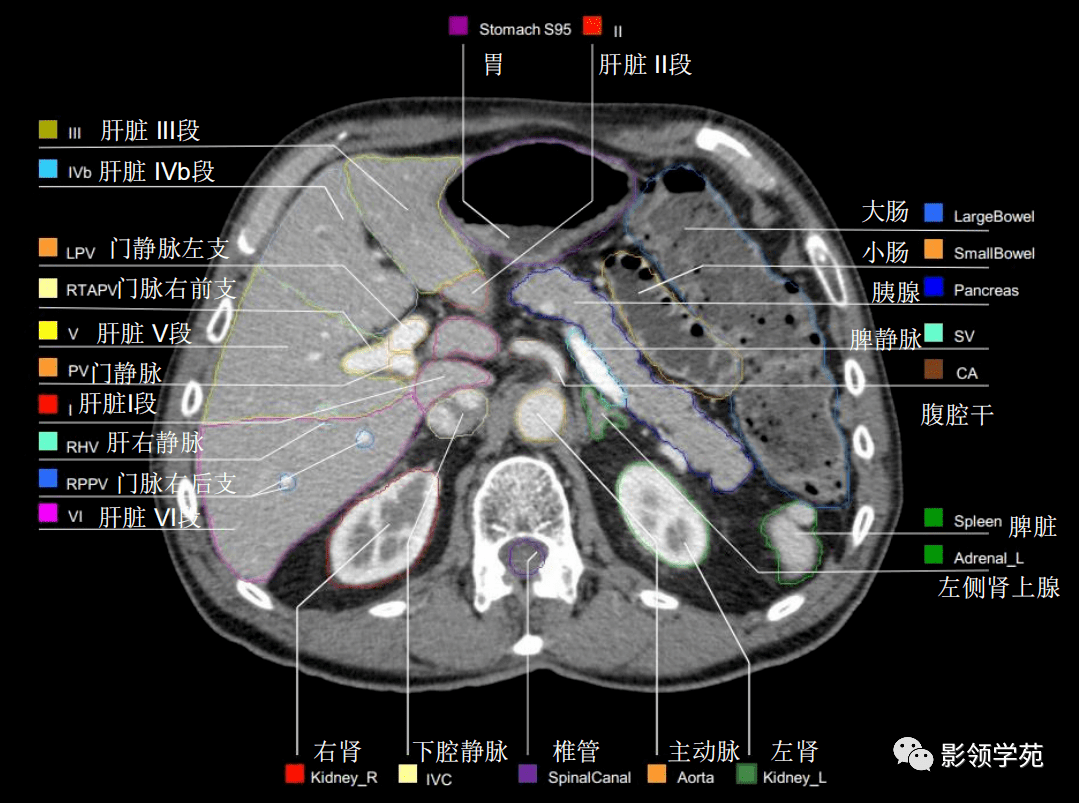图3-1-28 肠系膜上、下动脉分支及其小肠系膜内血管弓-基础医学-医学