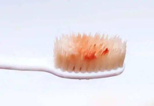 清洁|电动牙刷真的比普通牙刷好吗？我替你们问了医生