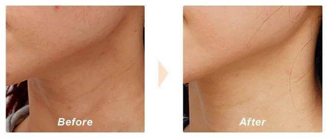 皮肤|抹出“宛如天生”的素颜肌,全靠这个小红罐面霜