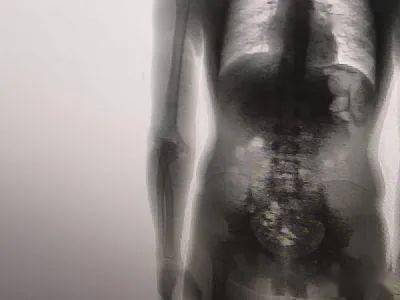 塞2斤金条藏8部手机…人类对肛门的探索太可怕了