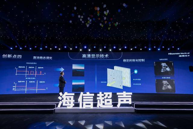 台超声|运算能力较传统方案提升一倍 海信首台超声产品正式发布