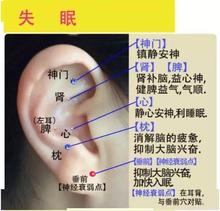 搭脉怎么判断早搏_早搏心电图怎么看图解(3)