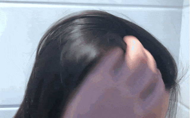 什么|连头发都快拼没了，你拿什么安身立命？