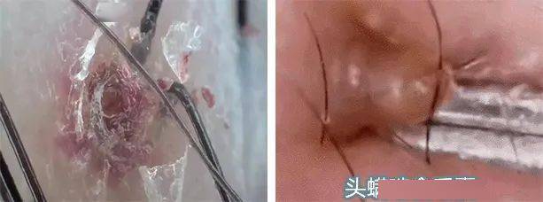 什么|连头发都快拼没了，你拿什么安身立命？